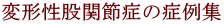 変形性股関節症の症例集